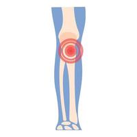 vector de dibujos animados de icono de artritis de rodilla. dolor en las articulaciones