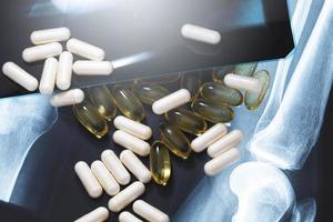 Close-up of X-ray image and different pills and capsules photo