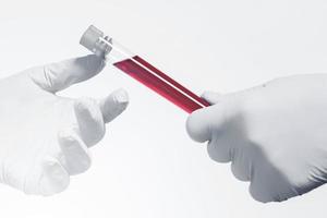 Vacutainer of blood sample and scientist's hand wearing latex gloves photo