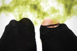 pies masculinos en calcetines viejos malolientes y sucios foto