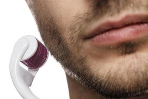 Man is using derma roller for beard growth photo