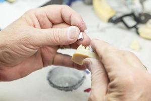 Dental Technician Working On 3D Printed Mold For Tooth Implants photo