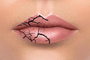 Closeup of chapped lips with a cracks photo
