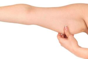 Woman holding her hand with excess fat, isolated on a white background photo