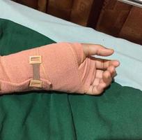 hand of a small child who is being bandaged after surgery. photo