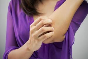 Itching occur on the elbow photo