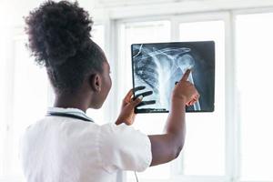 X-ray film image with doctor for medical and radiological diagnosis on female patients health on disease and bone cancer illness, healthcare hospital service concept