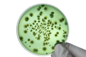 Hand with Petri dish or culture media with bacteria on white background with clipping, Test various germs, virus, Coronavirus, COVID-19, Microbial population count, Food science. png