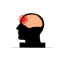 hoofdpijn en hersenen trauma png