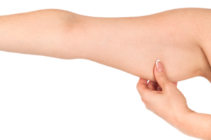 Woman holding her hand with excess fat, isolated png