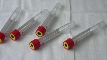 Plastic test tubes with caps for the collection of samples. Medical modern medicine video