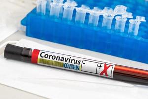tubo de análisis de sangre de coronavirus positivo colocado en la mesa de laboratorio foto