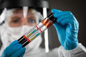 Female Doctor or Nurse Holding Test Tubes of Blood Labeled Positive for Coronavirus COVID-19 Disease photo