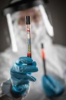 Female Lab Worker Holds Test Tube of Blood Labeled Coronavirus COVID-19 Disease photo