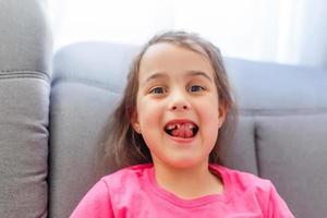 little girl pointing her missing teeth photo