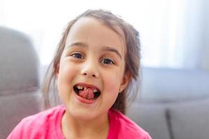 Young baby's teeth are shown close-up. A child's smile without one tooth photo