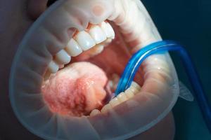 close up of girl's teeth at dental clinic photo