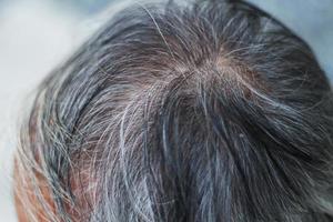 Close up gray hair roots man, Thin hair man photo