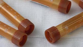 Plastic test tubes with brown caps for the collection of samples. Medical modern medicine video