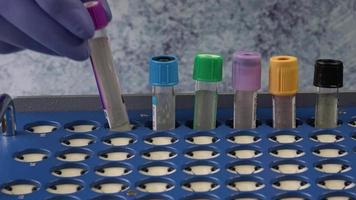 tubos de ensaio de plástico com tampas para a coleta de amostras. suporte de tubos de ensaio. medicina moderna médica