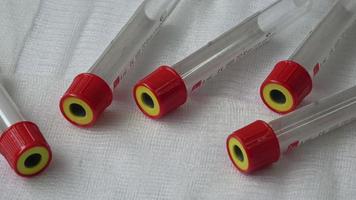 tubos de ensayo de plástico con tapas para la recogida de muestras. medicina moderna medica video