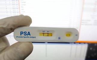 Rapid diagnostic test for PSA or Prostate Specific Antigen with a positive result. Rapid test cassette photo