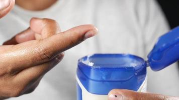 Close Up Of Man Hand Using Petroleum Jelly video