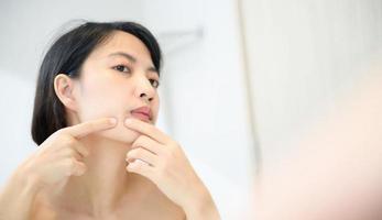 Problem skin. Concerned young asian women popping pimple on cheek while standing near mirror in bathroom. young asian women with acne photo