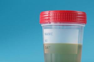orina en un recipiente de prueba con una tapa roja sobre un fondo azul. concepto médico y de salud. foto