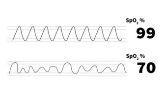 normal oxygen saturation waveform with poor baseline waveform monitoring vector