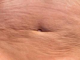 A woman's flabby stomach with wrinkles after losing weight. The concept of plastic surgery photo