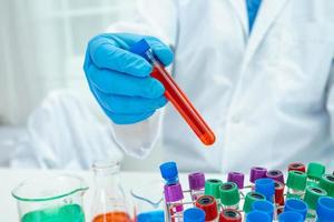 Scientist holding and analysis tube of micro biological sample with a microscope in laboratory for doctor in the world. photo