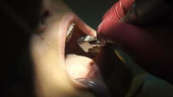 close-up da menina encantadora trata os dentes do dentista video