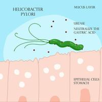 helicobacter pylori en la capa mucosa del estómago infografía vector