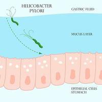 Helicobacter pylori in mucosal layer in stomach illustration vector