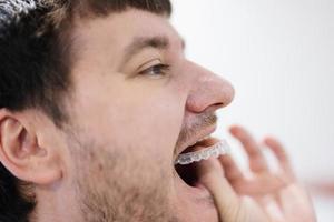 aparato de ortodoncia móvil para la corrección dental. hombre con entrenador de ortodoncia de silicona o alineador de aparatos ortopédicos invisibles. foto