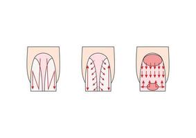 instrucción de manicura. ilustraciones vectoriales de uñas. dedos de señora. vector