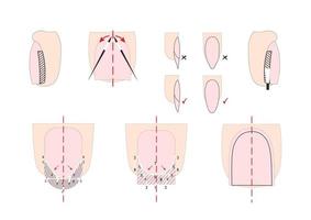 Instrucciones de manicura de uñas con ilustraciones y detalles. vector