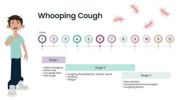 Whooping Cough Pertussis Symptom Timeline vector illustration infographic