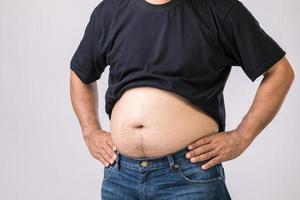 concepto de chequeo médico gente gorda mostrando su gran barriga. utilizado para el problema del hígado o el concepto de obesidad. foto de estudio en gris
