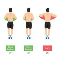 The push up dominant muscle. How to do push up from top view. Hand position. Chest and tricep or injury dominant. Neutral position and internal rotation. Flat vector illustration isolated on white