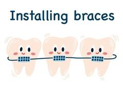 Installing braces. Cute cartoon teeth with braces. Cheerful icons. Straightening teeth. Correction of byte. Dentistry. Orthodontics. Dental care. Metal braces. Straight teeth. Vector illustration