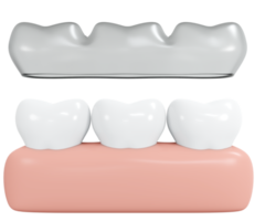 rendu 3d dents invisalign avec style de dessin animé d'icône de gomme. illustration de rendu 3d. png