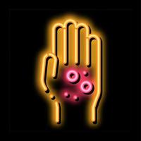 dermatitis rash on hands neon glow icon illustration vector