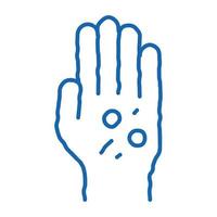 dermatitis rash on hands doodle icon hand drawn illustration vector