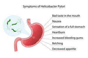 Helicobacter pylori infection symptoms infographic. Vector illustration, cartoon style