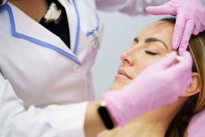 médico estético pintando en el rostro de su paciente las zonas a tratar con toxina botulínica. foto