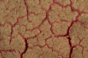 covid19 lung coronavirus virus affected macro photo