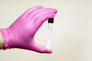 hand holds closed test tube over light table photo