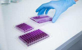 cell culture at the medicine, medical and cell culture laboratory photo